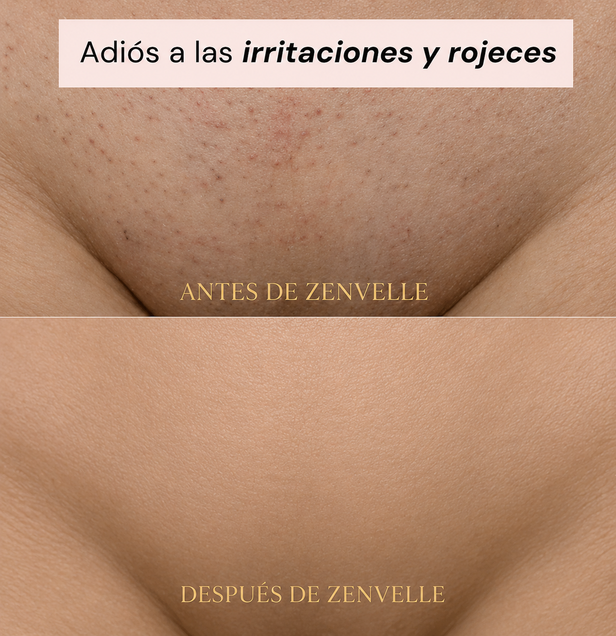 DEPILADORA DOBLE CABEZAL
