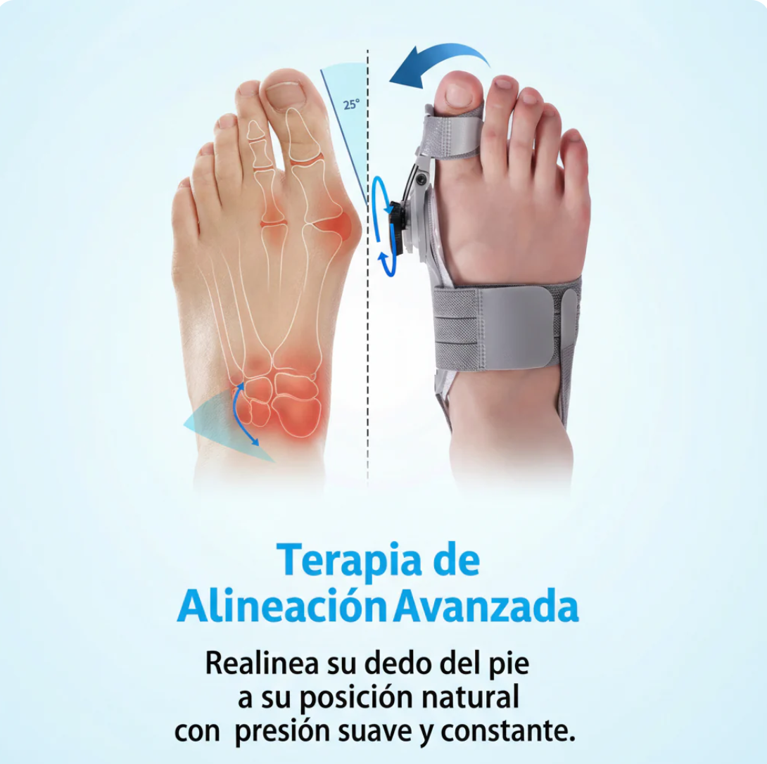 OrthoFlex™: Sistema Corrector de Juanetes